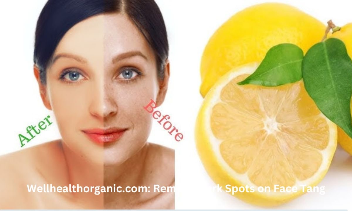 Wellhealthorganic.com: Remove Dark Spots on Face Tang