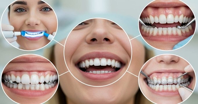3 Cosmetic Dentistry Options That Work Well Across Generations