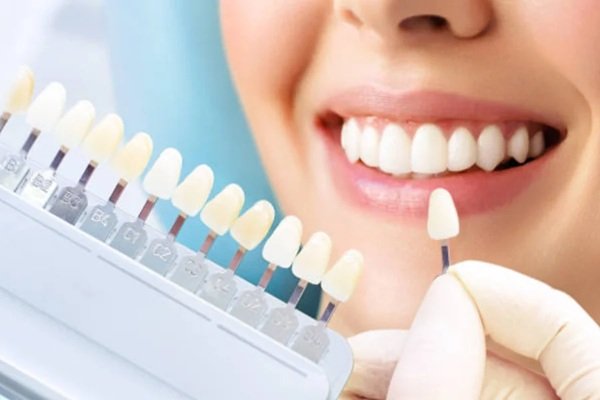 5 Preventive Strategies That Keep Cosmetic Dentistry Results Bright