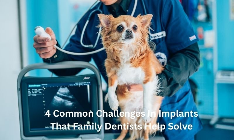 4 Common Challenges In Implants That Family Dentists Help Solve